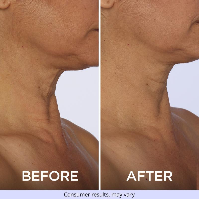 Revitalize Your Neck with GOPURE Neck Cream - Firming & Lifting Solution for Crepey Skin